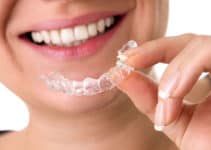 A Complete Guide to Wearing an Orthodontic Retainer