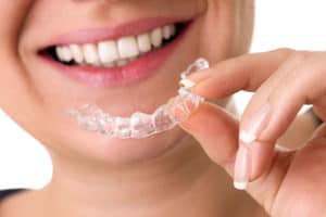 A Complete Guide to Wearing an Orthodontic Retainer